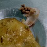 Un médico encontró una uña postiza dentro de la comida que le sirvieron en el hospital